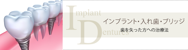 インプラント・入れ歯・ブリッジ
